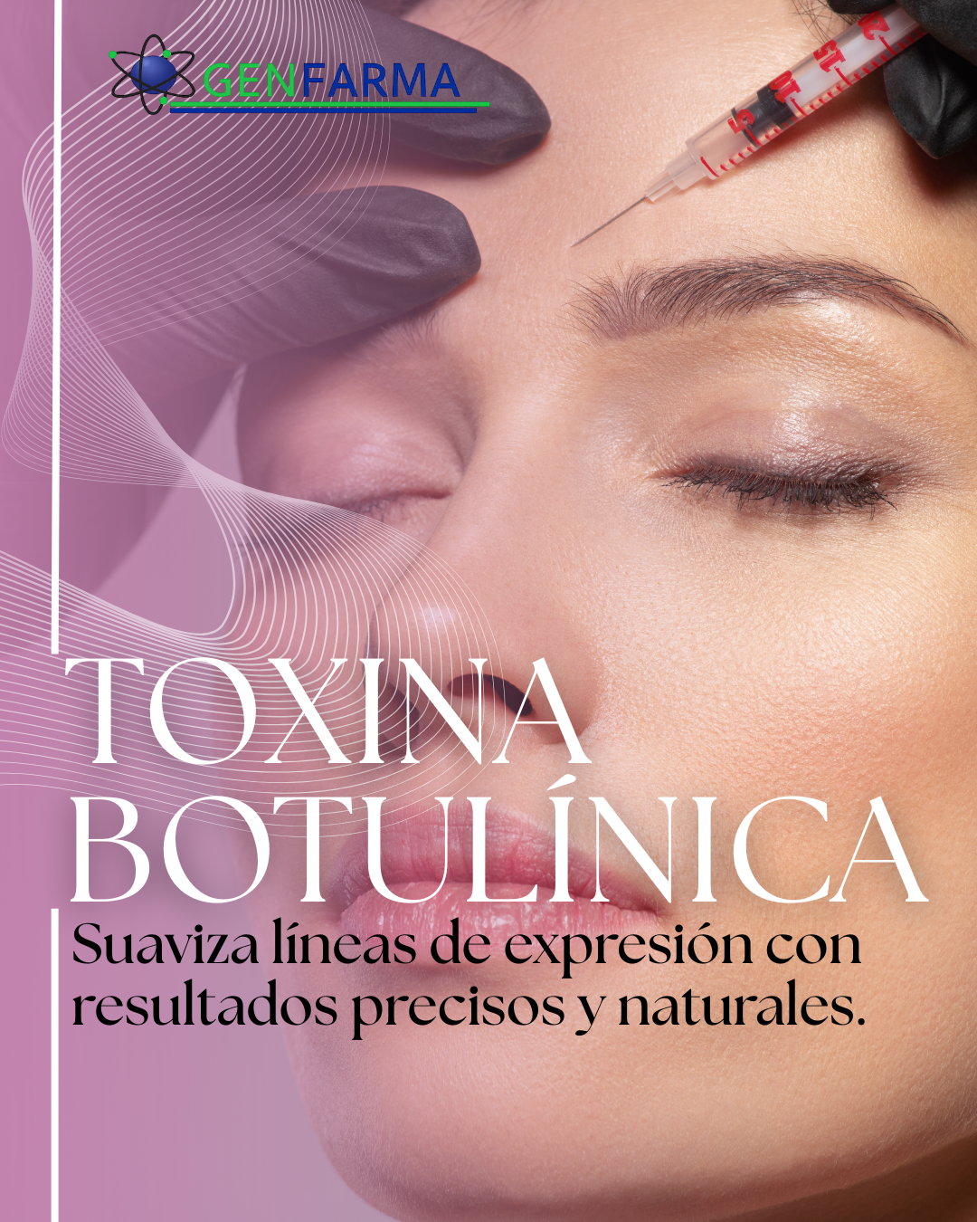 Toxina botulínica